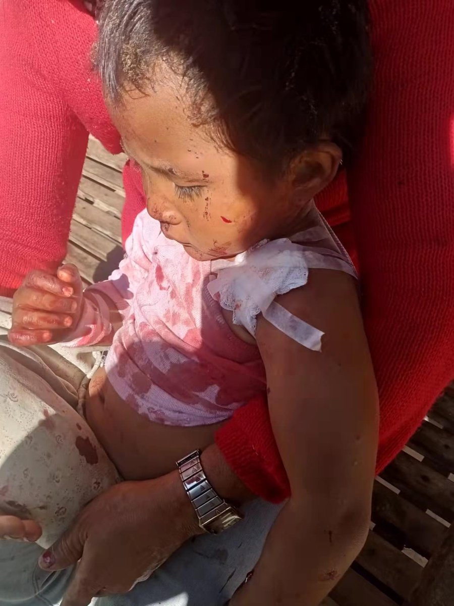 TheChindwin's tweet photo. Myanmar military’s shelling of heavy #weapons has landed in the border town – Namhkan in northern #Shan State, injuring six civilians, including two children aged 5 and 2. 
Locals have confirmed the shelling of weapons against the civilian occurred before a clash has happened. https://t.co/4KmLXfDDyN