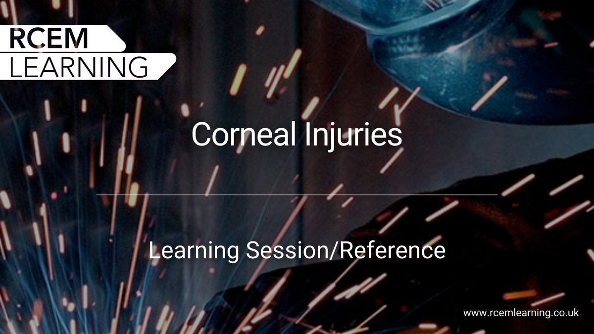 RCEMLearning's tweet photo. Eye injuries are a leading cause of visual loss and blindness often affecting young people. Today's session will cover the assessment and management of corneal injuries.

LS🔒Members➡️ https://t.co/akXzLq3w8o
Ref🆓#FOAMed👉 https://t.co/uuS8gwT8ba https://t.co/HSZr4aSBes