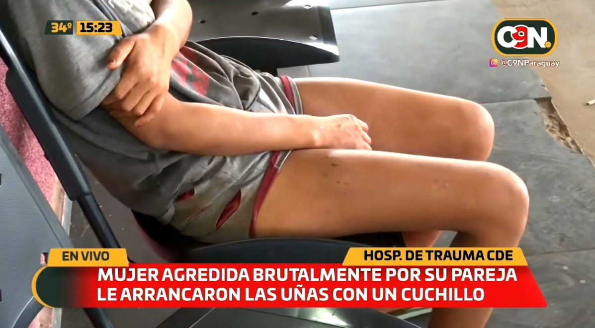 C9NParaguay's tweet photo. 😡Mujer es brutalmente golpeada por su pareja.

La victima presenta varias lesiones en el cuerpo. Pide que la justicia intervenga y tomen las acciones correspondientes.😪

#NiUnaMenos 

🔗https://t.co/ZjsduBNmVk https://t.co/bTouRGHHI2