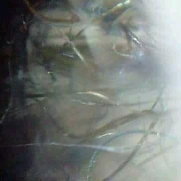 morgellons leicester UK. tweet media