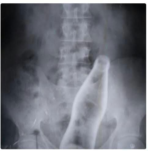 Ipo siku mtajifunza kwann wanaume waliumbwa kwaajili yenu 👇👇👇👇📌📌📌