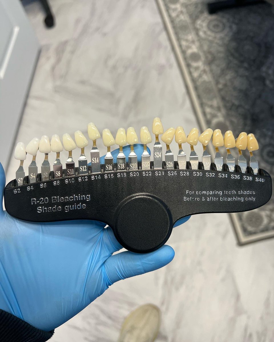CSmilelabs's tweet photo. 🤯 THE POWER OF ONE SESSION 🤯

s/o @reubensalem for stopping by today and helping us show how even just ONE session can make a noticeable difference; in this case, he ended 10-12 shades whiter! 

Book your sessions today at https://t.co/hHBrzVhuz6 or the tab in our bio 😁🦷 https://t.co/7eN2YaLVw1