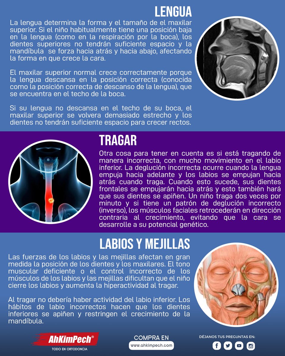 AhKimPechMX's tweet photo. Los verdaderos responsables del apiñamiento dental son la respiración por la boca, el empuje de la lengua, la deglución inversa y la succión del pulgar, que se conocen como hábitos miofuncionales incorrectos. #myobrace #miofuncional #ortodoncista #dentista #odontologo https://t.co/MgKmHyLnd0