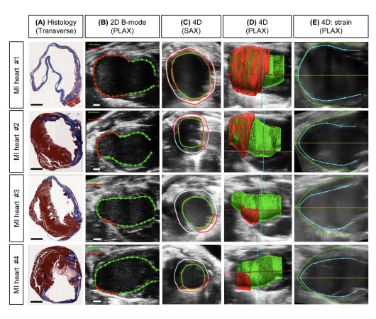 AJP-Heart and Circ (@ajpheartcirc) on Twitter photo #ArticlesInPress: Quantification of Murine #Myocardial Infarct Size using 2D and 4D High Frequency #Ultrasound
(Dann et al.)
ow.ly/Caxq50HtGtP
<a href="/craig_goergen/">Craig Goergen</a> <a href="/HanKimLab/">Han Kim</a> <a href="/serenapulente/">Serena Pulente</a>
<a href="/Conner_C_Earl/">Conner Earl</a> <a href="/NatashaTrza/">Natasha Trzaskalski</a> <a href="/uOttawaBMI/">uOttawaBMI</a>
#echocardiography #mousemodels
#InfarctSize #ArticlesInPress: Quantification of Murine #Myocardial Infarct Size using 2D and 4D High Frequency #Ultrasound
(Dann et al.)
ow.ly/Caxq50HtGtP
<a href="/craig_goergen/">Craig Goergen</a> <a href="/HanKimLab/">Han Kim</a> <a href="/serenapulente/">Serena Pulente</a>
<a href="/Conner_C_Earl/">Conner Earl</a> <a href="/NatashaTrza/">Natasha Trzaskalski</a> <a href="/uOttawaBMI/">uOttawaBMI</a>
#echocardiography #mousemodels
#InfarctSize