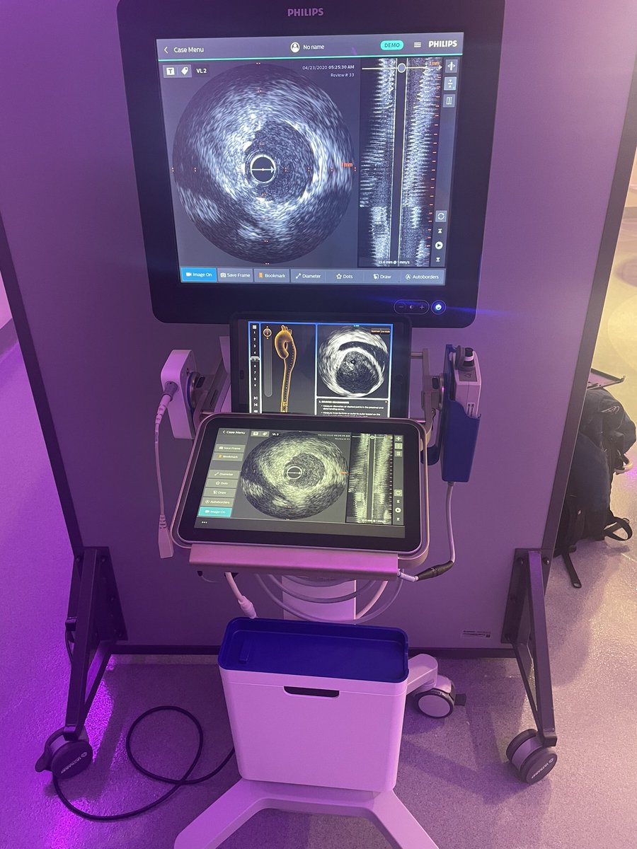 Brandon Van Asseldonk (@bvanasseldonk) on Twitter photo Inaugural case in the <a href="/Sunnybrook/">Sunnybrook Health Sciences Centre</a> hybrid OR today. Amazing space with cutting edge technology to help us deliver world class patient care. <a href="/UofTVascular/">UofT Vascular Surgery</a> <a href="/AndrewDueckMD/">Andrew Dueck</a> <a href="/ahmedkayssi/">Ahmed Kayssi</a> <a href="/SavingLegs/">Project Saving Legs</a> Inaugural case in the <a href="/Sunnybrook/">Sunnybrook Health Sciences Centre</a> hybrid OR today. Amazing space with cutting edge technology to help us deliver world class patient care. <a href="/UofTVascular/">UofT Vascular Surgery</a> <a href="/AndrewDueckMD/">Andrew Dueck</a> <a href="/ahmedkayssi/">Ahmed Kayssi</a> <a href="/SavingLegs/">Project Saving Legs</a>