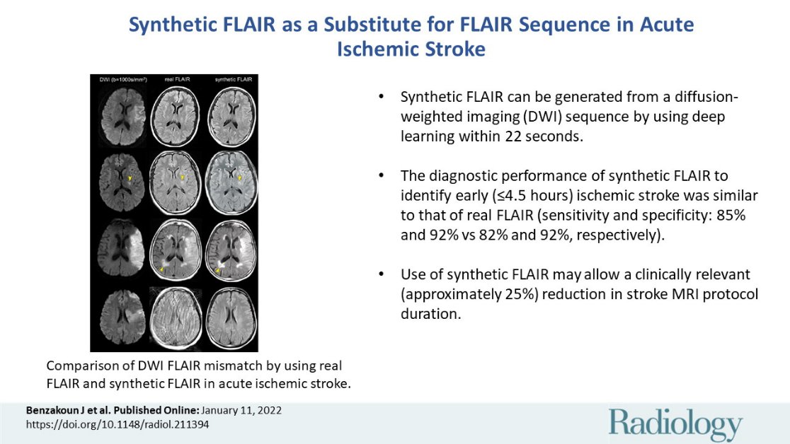 Radiology (@radiology_rsna) on Twitter photo Synthetic fluid-attenuated inversion recovery (FLAIR) generated with deep learning is as accurate as a real FLAIR sequence for the identification of early stroke. bit.ly/3r299e0 #NeuroRad @BertrandThirion <a href="/oliviernaggara/">Naggara</a> <a href="/GhuParis/">GHU Paris Psy-Neuro</a> <a href="/Insermu1266/">Inserm Paris 5 Ipnp</a> <a href="/Parietal_INRIA/">Parietal, INRIA</a> Synthetic fluid-attenuated inversion recovery (FLAIR) generated with deep learning is as accurate as a real FLAIR sequence for the identification of early stroke. bit.ly/3r299e0 #NeuroRad @BertrandThirion <a href="/oliviernaggara/">Naggara</a> <a href="/GhuParis/">GHU Paris Psy-Neuro</a> <a href="/Insermu1266/">Inserm Paris 5 Ipnp</a> <a href="/Parietal_INRIA/">Parietal, INRIA</a>