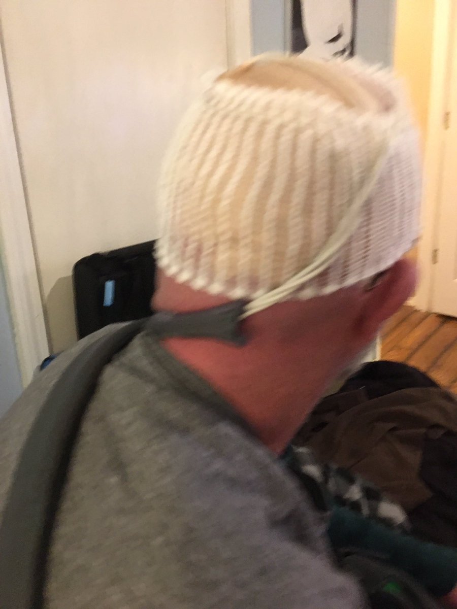 BenJammin1968's tweet photo. Fighting GBM brain π§ cancer wearing #optune to battle this nasty shit. #alwaysgrateful #neverwithouthope https://t.co/CxlbGbNKlK