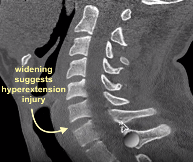 Tim Luijkx tweet media