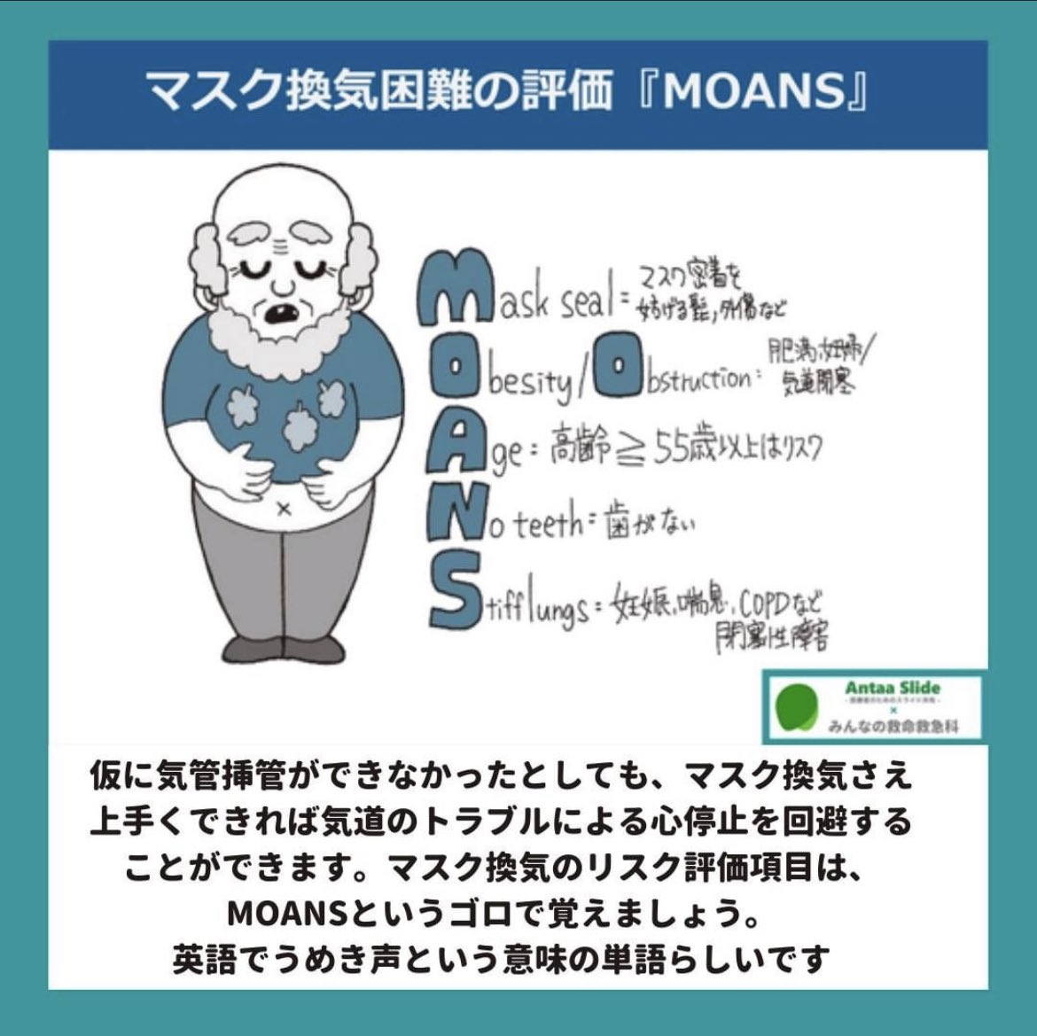仮に気管挿管ができなかったとしても、マスク換気さえ上手くできれば気道のトラブルによる心停止を回避することができます。 マスク換気のリスク評価項目は、MOANSというゴロで覚えましょう。  英語でうめき声という意味の単語らしいです。