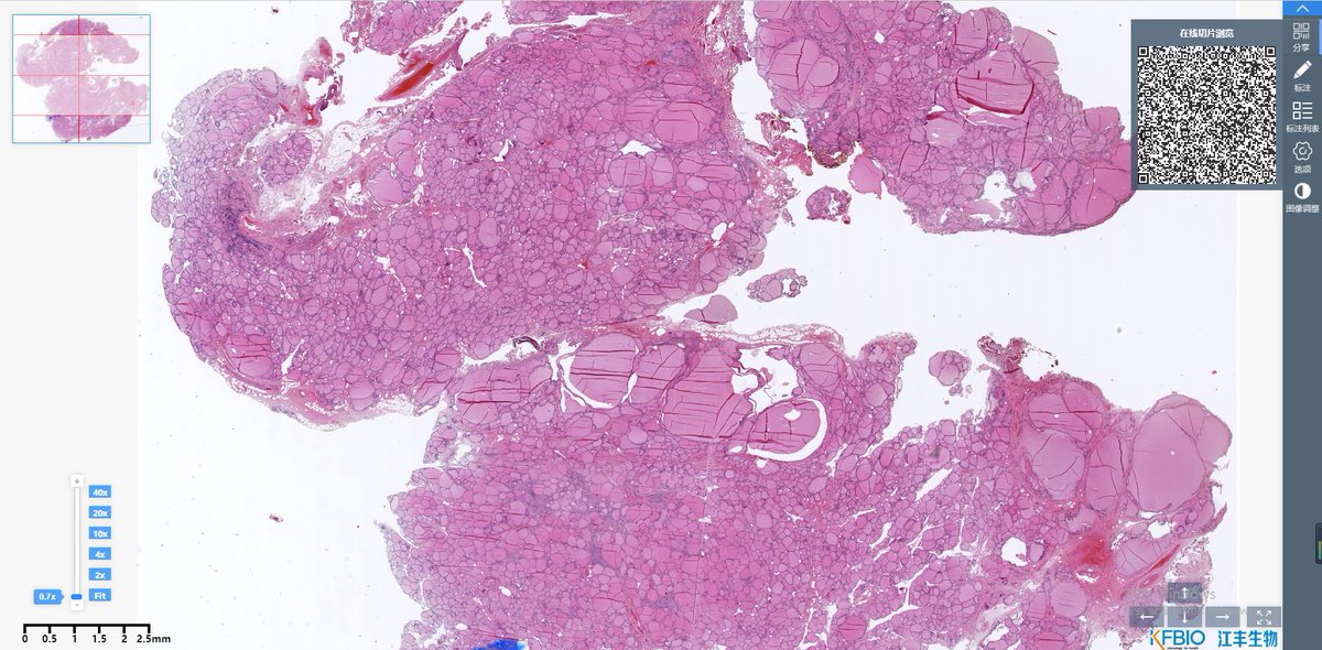 KFBIO1's tweet photo. and then share pathology images or view images on mobile devices.
Finally, the cloud will become an effective communication platform for the pathologist, which will contribute greatly to pathology diagnosis.
#pathologycloud
#pathologyimage
#digitalpathology https://t.co/sYpTOt87P1