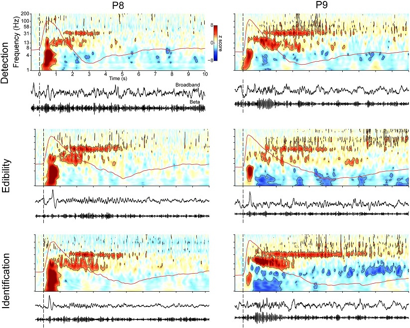 PLOSBiology's tweet photo. Smell-induced oscillations. Intracranial recordings from human #OlfactoryCortex reveal characteristic spectrotemporal response to odors, including theta, beta & gamma oscillations; hi-freq responses are needed for accurate perception of odors #PLOSBiology https://t.co/N5XVT8aCY5 https://t.co/qtzDxrTIwS