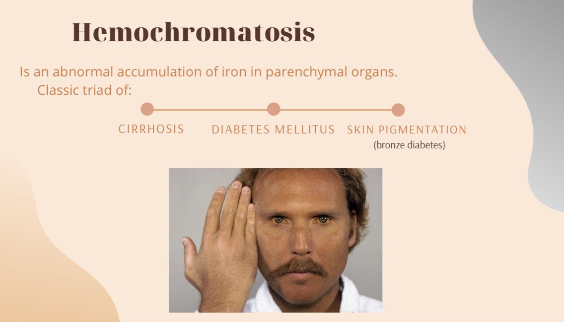Hemochromatosis Bronze Skin