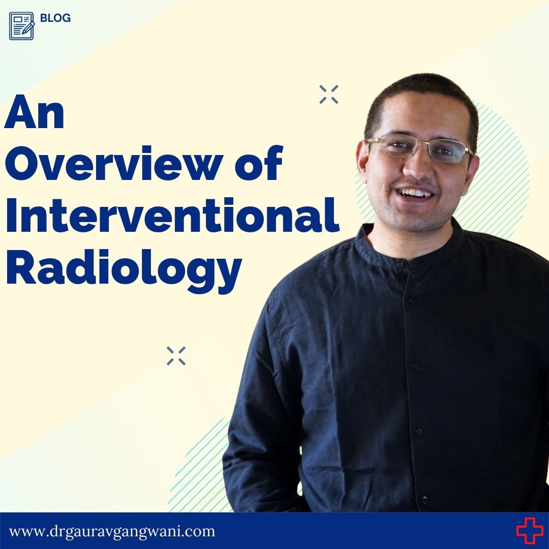 drgauravgangwni's tweet photo. BLOG: An overview of Interventional Radiology

To read full article, link - https://t.co/n9Z5gnzhrx
------------------
#interventionalradiology #indiandoctor #healthylife #avoidsurgery #bestdoctor  #radiology #medicalresearch #bestdoctor #interventionalradiologist https://t.co/dtylrdDGt0