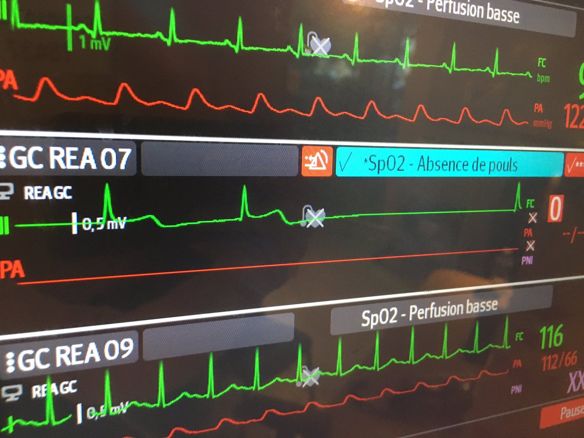 Fred Prabonnaud tweet media