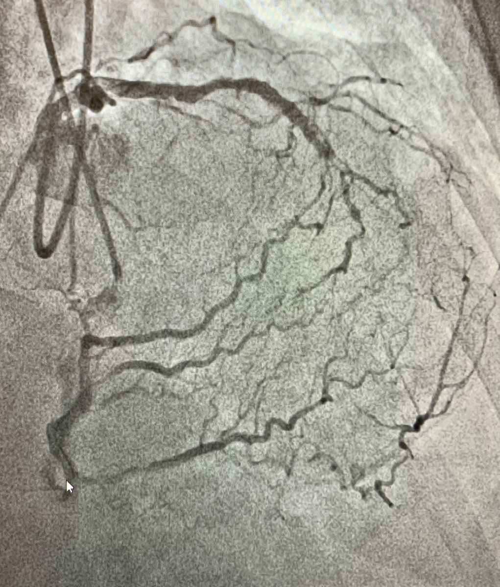 ReVascMed's tweet image. Another successful #CTOPCI at #PennsyInterventions to jumpstart 2022 with @jcgeorgemd. @GPAngioClub @ACVCPhila @PennCVFellows