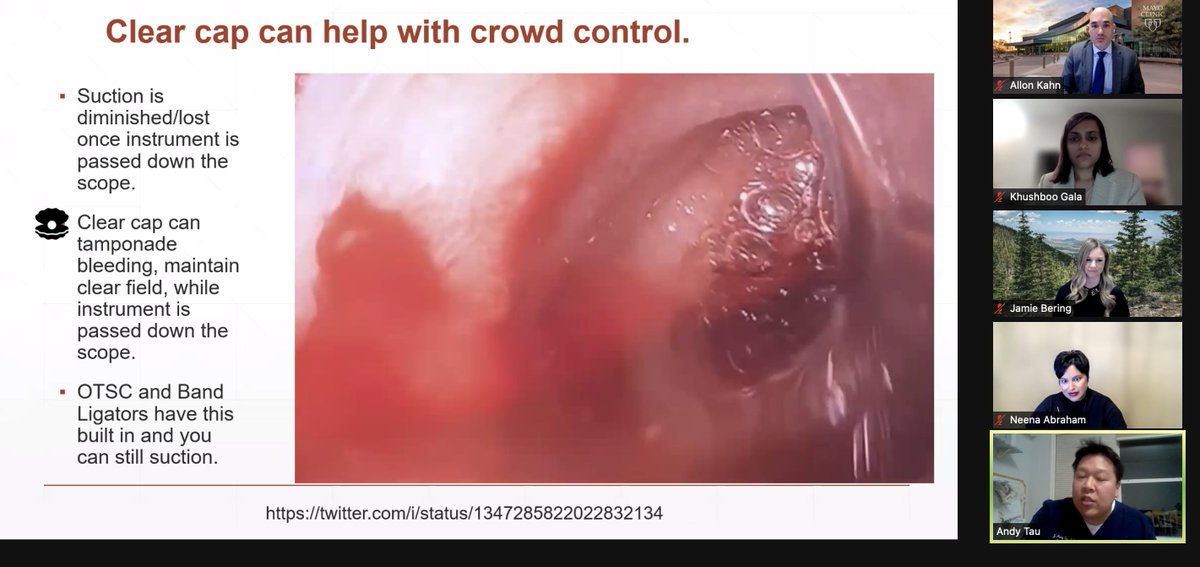 JamesHaddadMD's tweet image. #GITwitter's @DrBloodandGuts put on an absolute *CLINIC* on management of acute #GIBleeding for @ASGEendoscopy tonight.  Some favorite slides, including #PoiseuillesLaw, the #HungryDuodenoscope, and tips for #hemospray

1/2