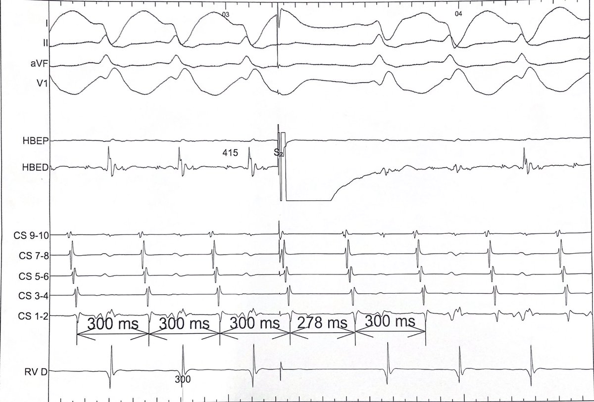Len Steinberg tweet media