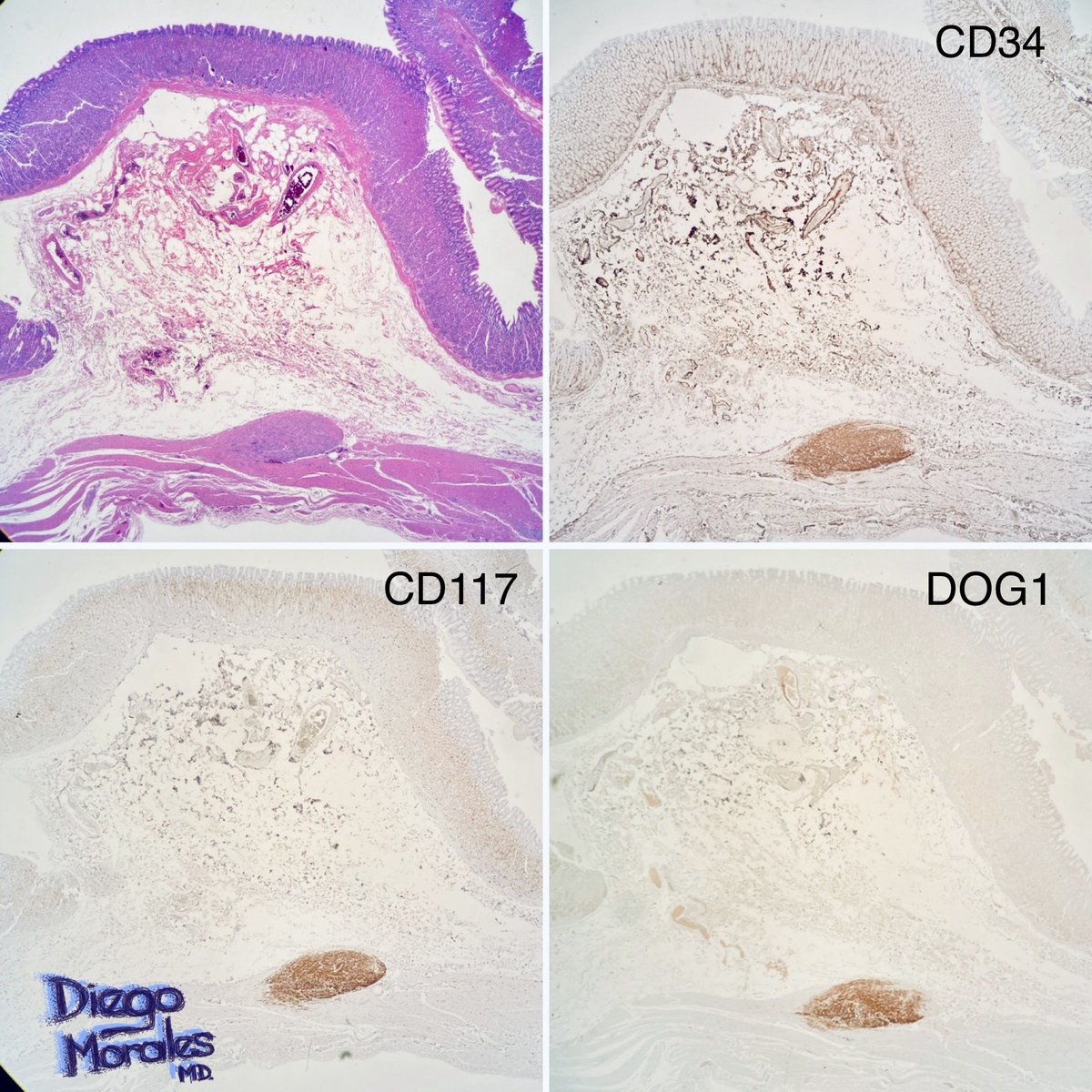 Diego Morales, MD tweet media