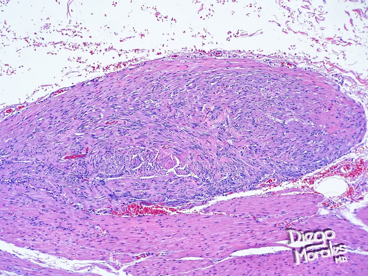 Diego Morales, MD tweet media