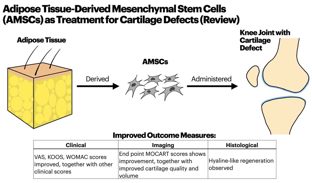 Pharmaceut_MDPI's tweet photo. Pharmaceuticals Feature Paper: #AdiposeTissue-Derived Mesenchymal Stem Cells as a Potential Restorative Treatment for #CartilageDefects: A PRISMA Review and Meta-Analysis.
#CartilageRepair #Osteoarthritis #Transplantation
📄Free to Read Via:
https://t.co/W9zv2YmDx0 https://t.co/mPHoFky35a