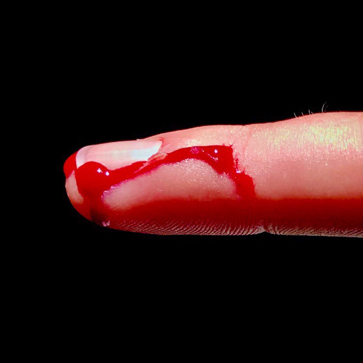 kid_smoko's tweet image. “I HOPE UR MISERABLE” OUT NOW ON ALL PLATFORMS! 

linktr.ee/Kidsmoko

👉🏻🩸👉🏻🩸👉🏻🩸👉🏻🩸👉🏻🩸👉🏻🩸👉🏻