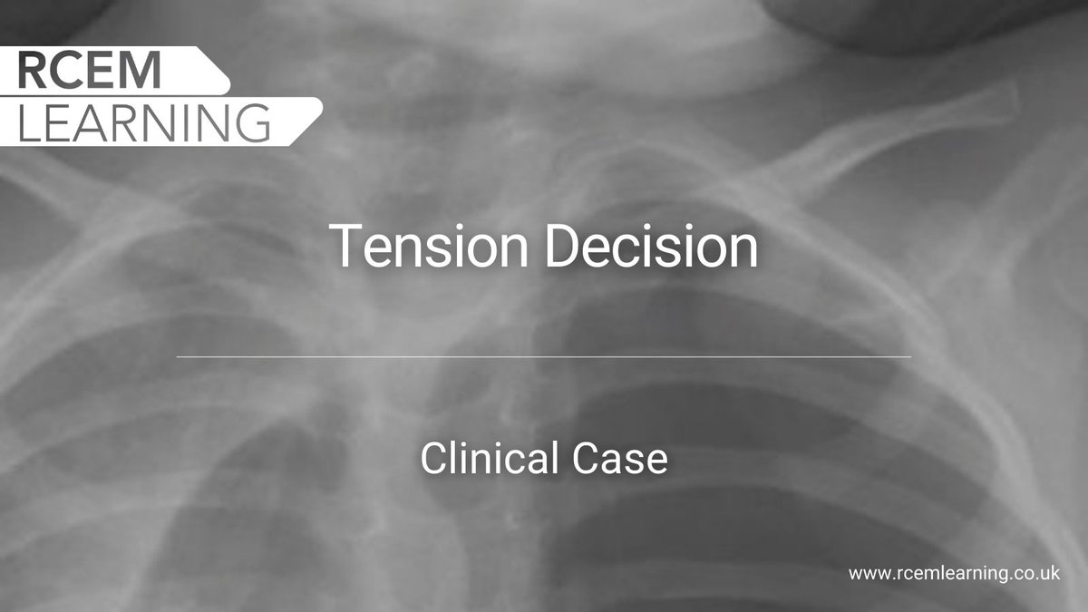 RCEMLearning's tweet photo. A 6-month-old girl was brought to your ED by her parents with five days of gradually increasing respiratory distress.

A plain chest radiograph is performed. Take a look ⬇️

Can you determine the most likely diagnosis?

#FOAMed ➡️ https://t.co/Wlefb2IDzT https://t.co/2t12GlrH4U