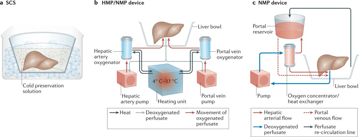 Online this week: "Machine perfusion of the liver: applications in transplantation and beyond" - Perspective article, read here: rdcu.be/cExsb
Fig.: Liver preservation: