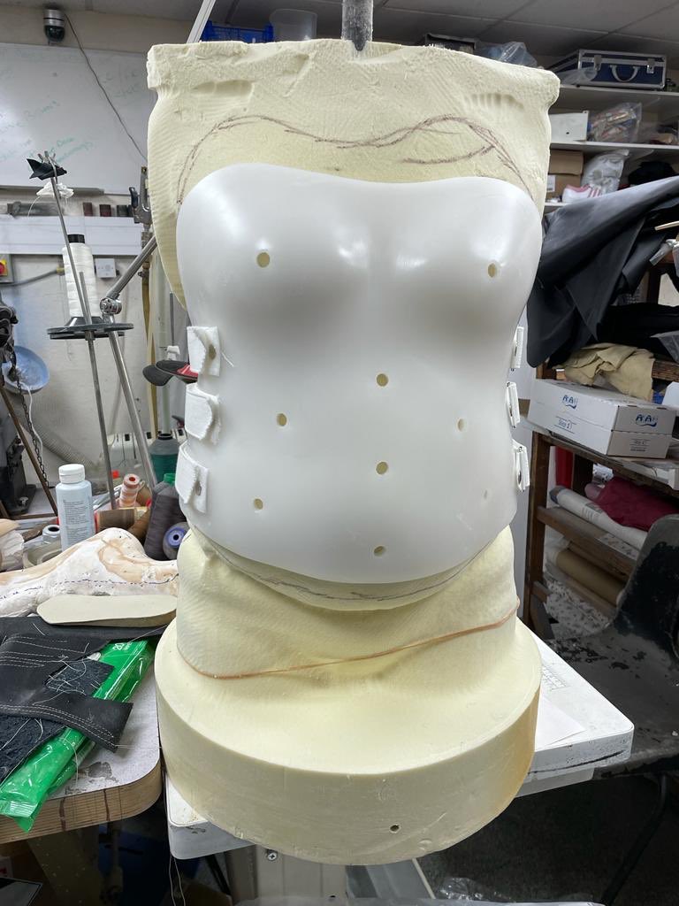 DevoteeBraces's tweet photo. Another day, another spinal corset.
#minerva #spinal #spinaljacket https://t.co/WGl1O9GOI0