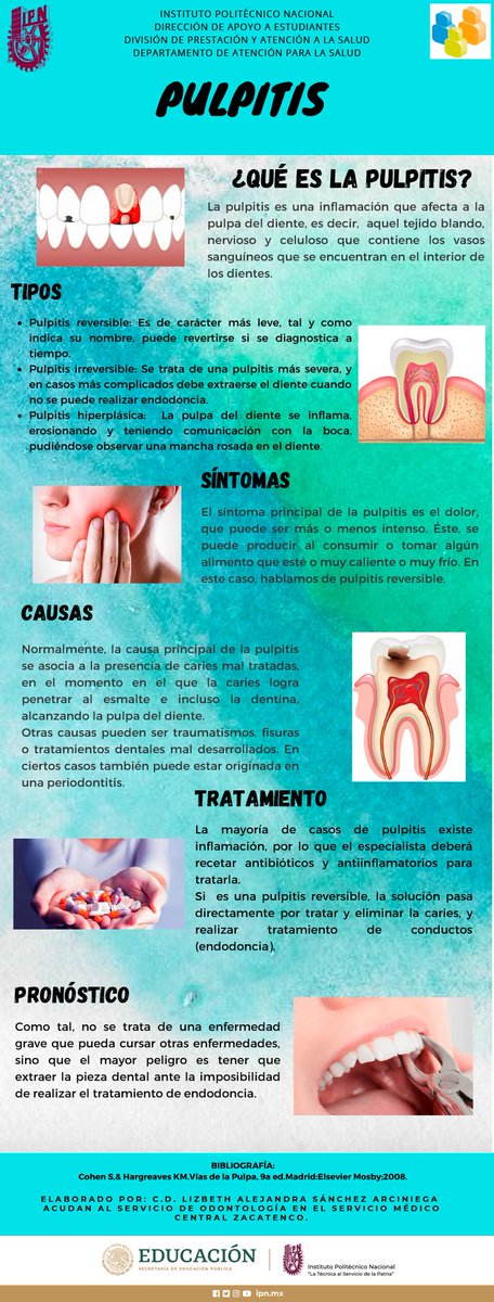 daes_ipn's tweet image. Dato:La #pulpitis es un proceso inflamatorio que afecta la pulpa del #diente a consecuencia de #caries o #fracturas
