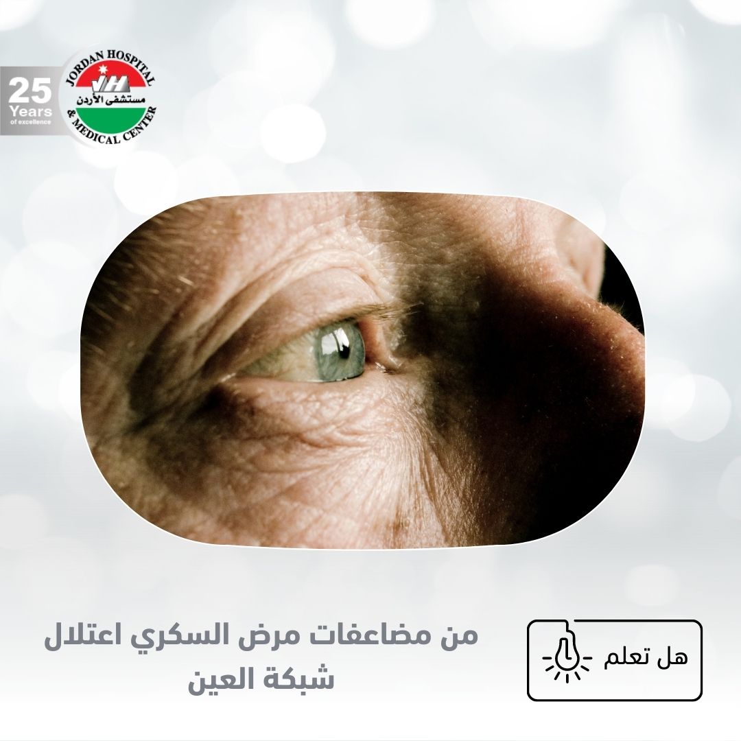JordanHospital's tweet photo. اعتلال الشبكية السكري هو أحد المضاعفات الناجمة عن الإصابة بداء السكري التي تصيب العينين. ويحدث بسبب ت��ف الأوعية الدموية في النسيج الحساس للضوء الواقع في الجزء الخلفي من العين (الشبكية).
#مستشفى_الأردن #صحة #أنتم_عائلتنا #نصائح_صحية #الشبكية  #JordanHospital #health #happy #love https://t.co/UIHrwlCEnB