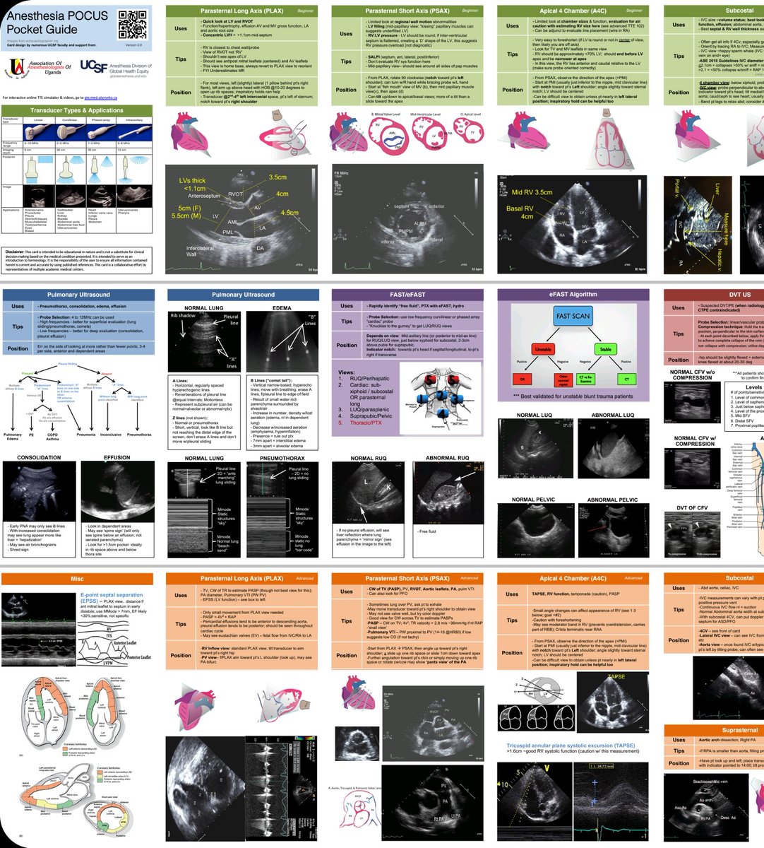 🔰POCUS pocket guide  
🔥Ultrasonido cardiaco, pulmonar, 📝FAST y avanzado en 1 sola imagen 
✅Descarga gratuita 
anesthesia.ucsf.edu/divisions/divi…
#abrohilo