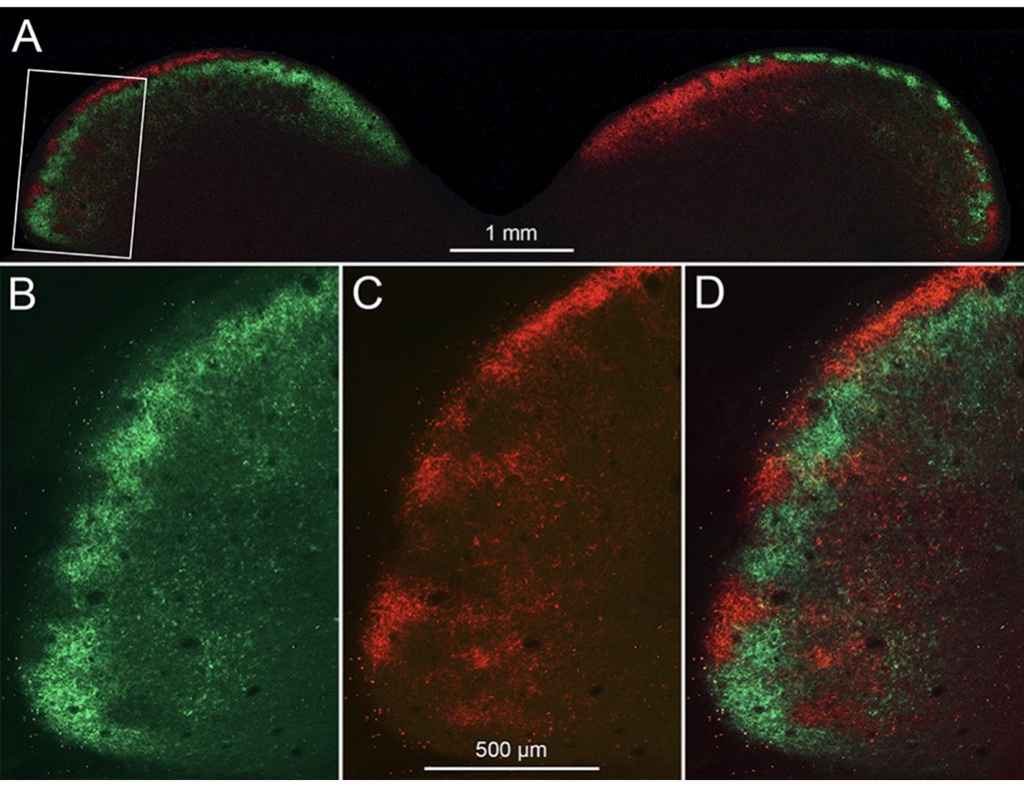 New from our lab:
Columnar and Laminar Segregation of Retinal Input to the Primate Superior Colliculus Revealed by Anterograde Tracer Injection Into Each Eye | IOVS | ARVO Journals iovs.arvojournals.org/article.aspx?a…