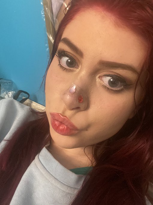 2 pic. I pimped my plaster!!
Starting to feel like myself ♥️♠️
Hopefully I can do something for you guys