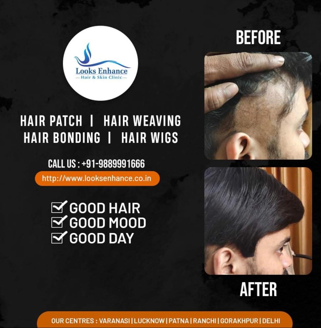 Arvind Gupta- Looks Enhance- Hair & Skin Clinic (@LooksEnhance) / Twitter Arvind Gupta- Looks Enhance- Hair & Skin Clinic (@LooksEnhance) / Twitter