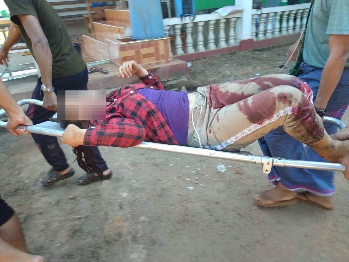 zoyaphan's tweet photo. Today in Kawkariek, Burmese military's artillery shelling injured 7 people including a 14 year old girl. This same military funded by American and French companies through gas revenue. President Biden @POTUS and President Macron must stop gas revenue going to the Burmese military https://t.co/d2I0OTA77e