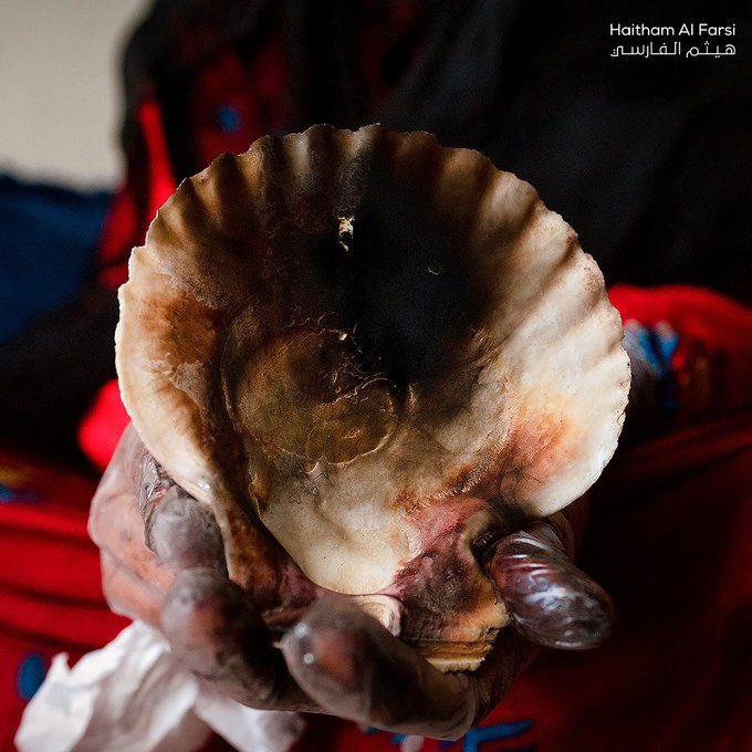 هل تعلمون ان النساء سابقاً في عمان الحبيبه كانوا يصنعون الكحل
من كبد سمك القرش 🦈
حريم قبل مايتعوضون تجيك الوحده مكحله وريحه وجهها زفر😜😂😂