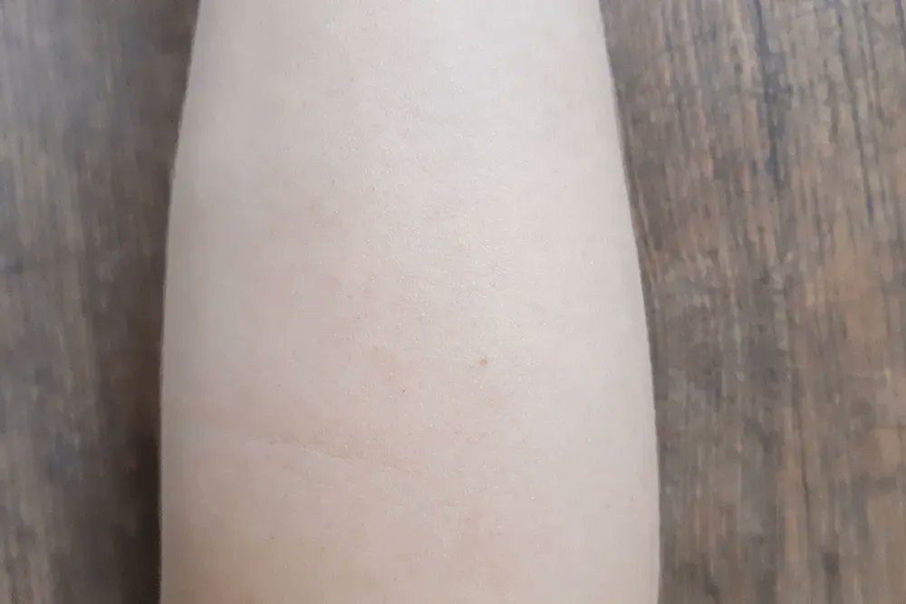 FamilyDocplus's tweet image. Hair removal with lasers guide

Laser hair removal is one of the most effective and efficient ways to remove unwanted hair today, both for women and men.

In 1997, the FDA approved the method itself, which was first discovered in the 1970s. 

Link: buff.ly/3qXTyfB