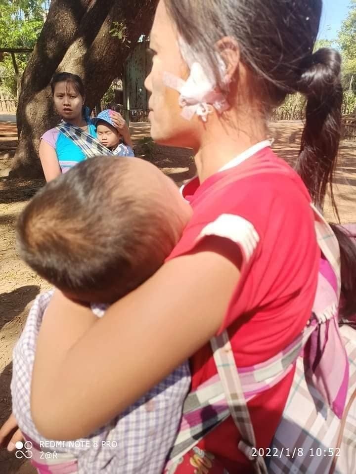 spring21MM's tweet photo. The number of refugees has increased in #Kawkayeik,Karen State as Military Terrorists were Deliberately Firing Heavy Artillery shells the whole day on Jan 8—Forcing at least 1k villagers from Satkawet &amp; Katoehta villages to flee,Damaging houses &amp; Injuring civilians.
#2022Jan8Coup https://t.co/zdXJk0DXpS