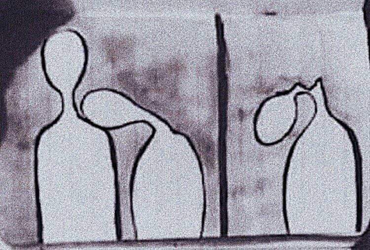 That's the face of emotional dependency for y'all. 
Ty. :)