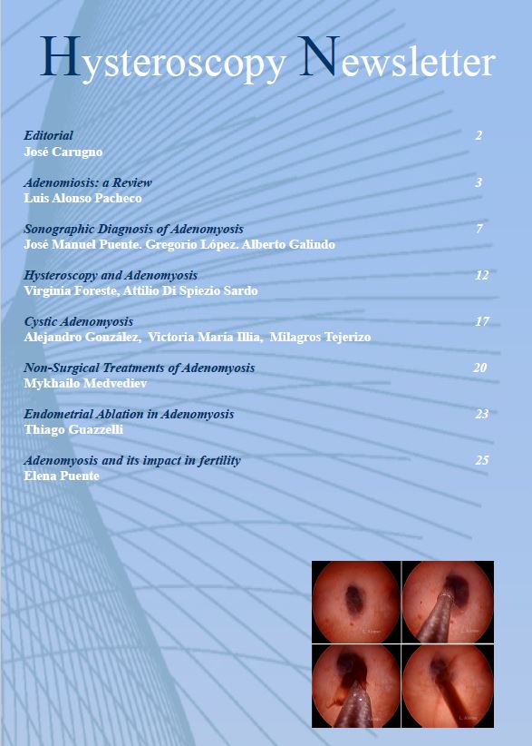 All About Adenomyosis - Hysteroscopy Newsletter Vol 8 Issue 1 hysteronews.files.wordpress.com/2022/01/hyster…