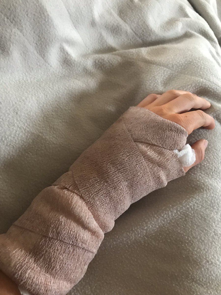 MBunjer's tweet photo. Hamate surgery✅                                       Wishing for a quick recovery to get back into the swing of everything         @ubanebraska  @NEspect_25s  @mnbaseball2020 https://t.co/k9zLXtTO1d