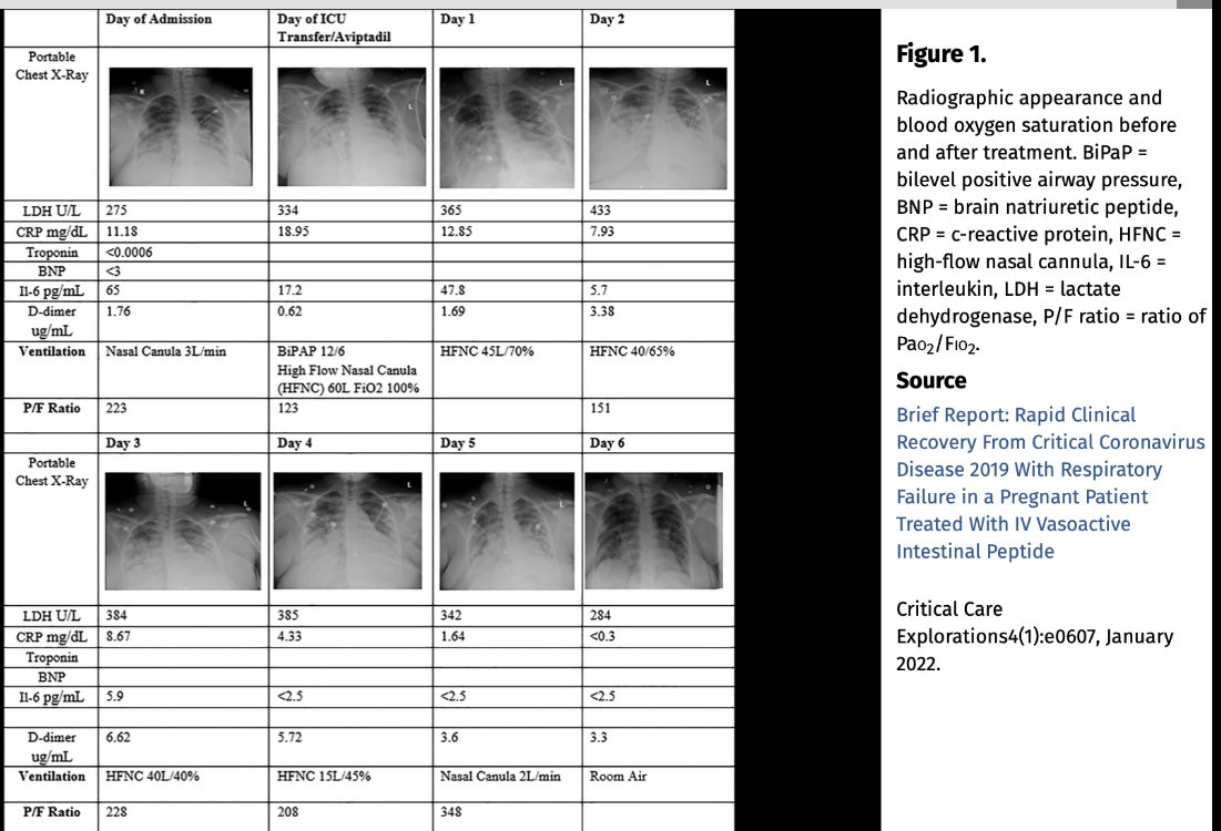 HarveySpecTrade's tweet photo. 32 year old, 27 weeks pregnant in the ICU with Covid. On the verge of needing to be intubated, 3 infusions of Aviptadil brought her back to room air in 6 days.

Both mother and baby survived. Remarkable stuff.
$NRXP $RLFTF

https://t.co/VUFyUWxUmB https://t.co/simHzPGyOU