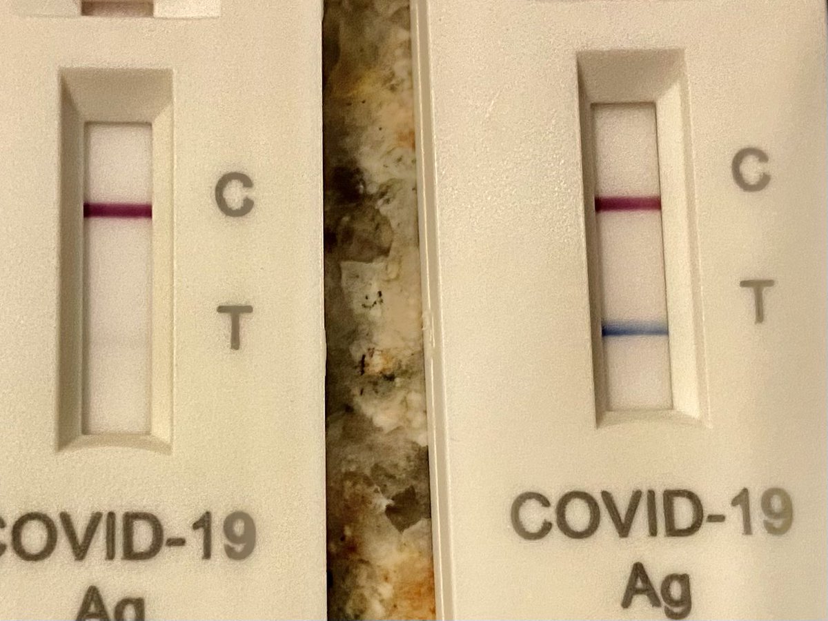 AAyiotis's tweet photo. 5 days post positive COVID test and my only remaining symptom is light congestion. My at home rapid test (left) still has a very faint line. @alaina_shumate’s is vibrantly blue even though she’s 8 days after the start of her symptoms. At least we know they’re working! https://t.co/zC9s2TgG1B