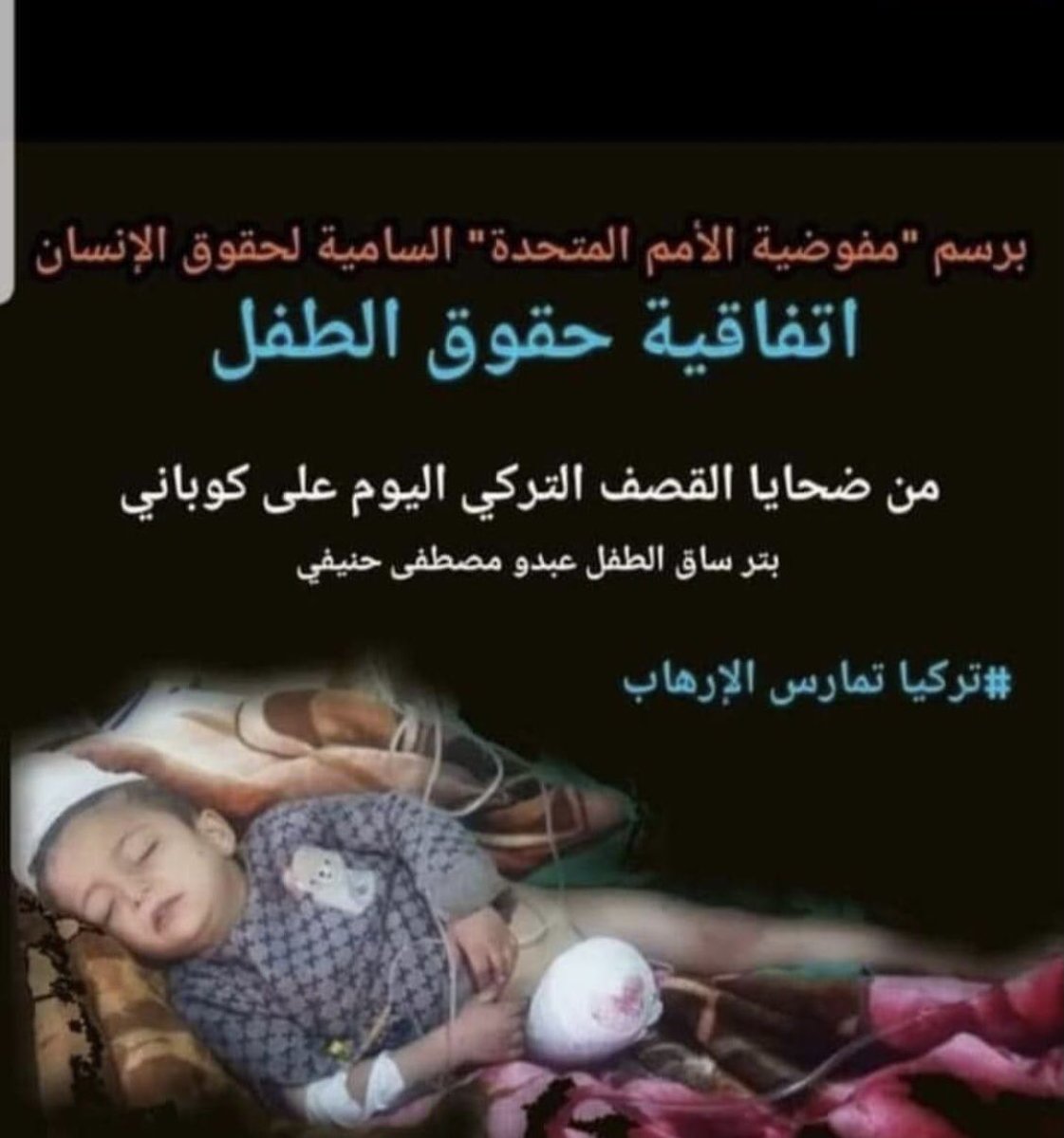 KingCan10's tweet photo. Among the victims of the Turkish bombing today on the city of Kobani # according to the United Nations High Commissioner for Human Rights # https://t.co/9Lke0Vf5SB