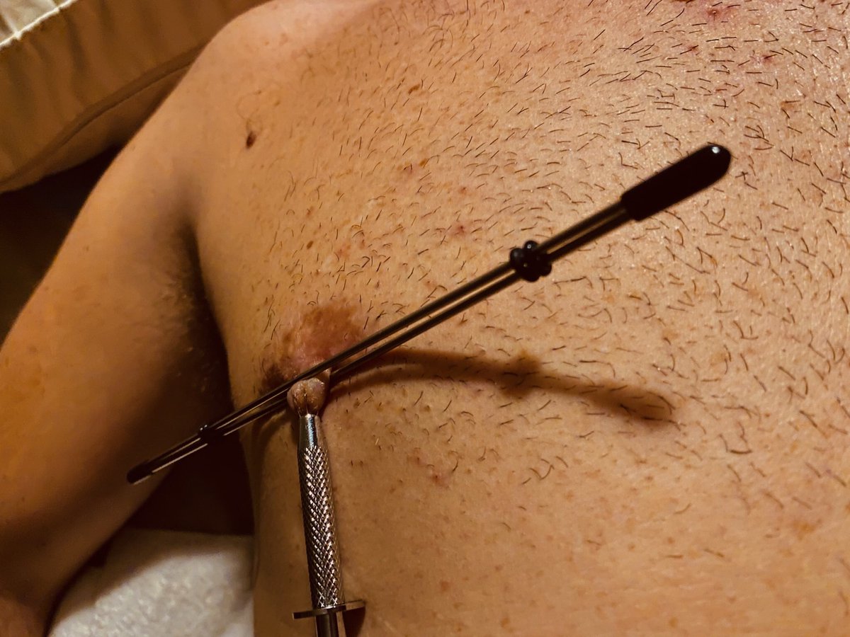 smokeslave2001's tweet photo. This combination of nipple clamps is vicious. If you are into #nippletorture you must try it. @MandyCynn definitely enjoyed seeing the #pain in my eyes. #bliss #masochist #cigaretteburning https://t.co/gK84fturCb