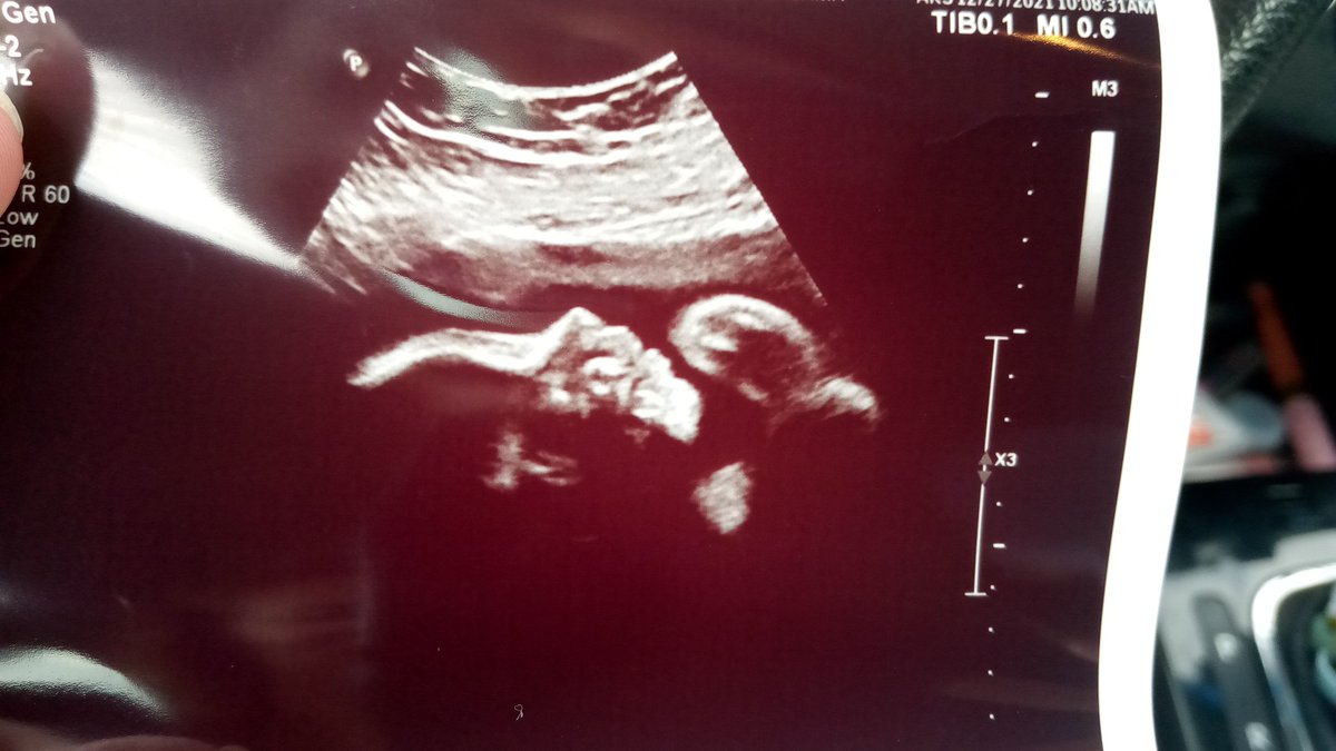 kennaalayne's tweet photo. ahhh 8 weeks ❤️😭 until we have our little man in our arms https://t.co/QX6PEnlXsW