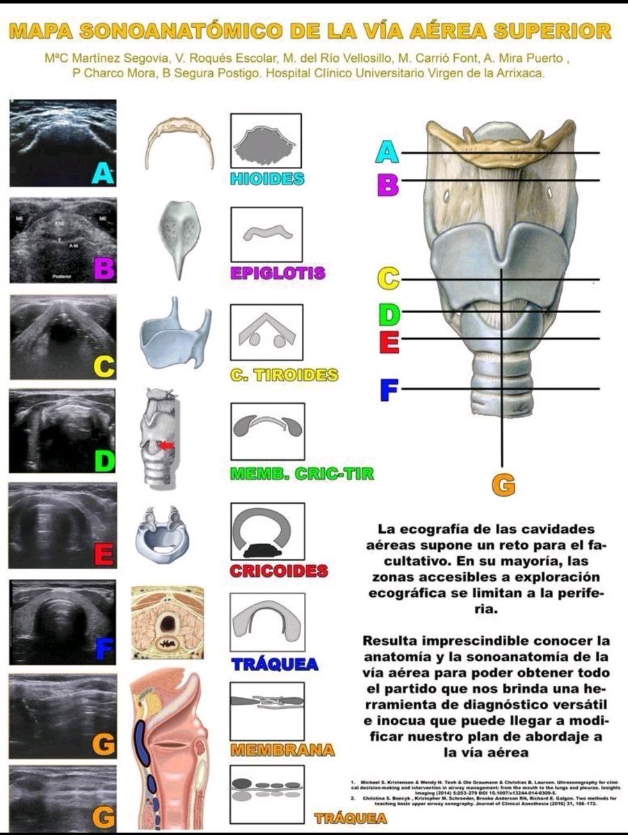 Correlación #EcográficoーAnatómica de la #VíaAéreaSuperior.

Vía: Juan Luis Lagartos Collado en <a href="/LinkedIn/">LinkedIn</a>.