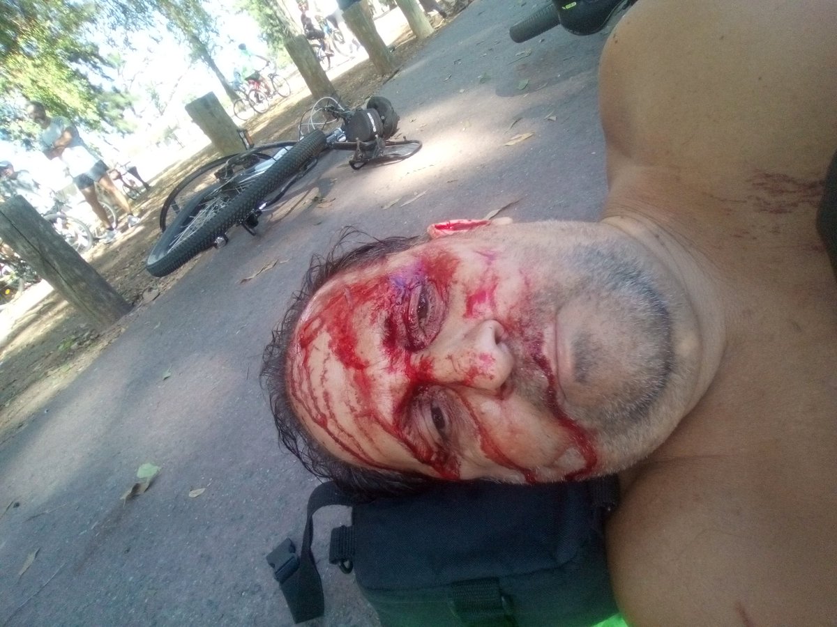 cdesirello's tweet photo. @DespegarAr @Aerolineas_AR @BAconsumidor Me MULTAN con 118.000 pesos porque estando gravemente en terapia intensiva sólo avisé la cancelación 24 hs antes... https://t.co/gvhMRMwfQB