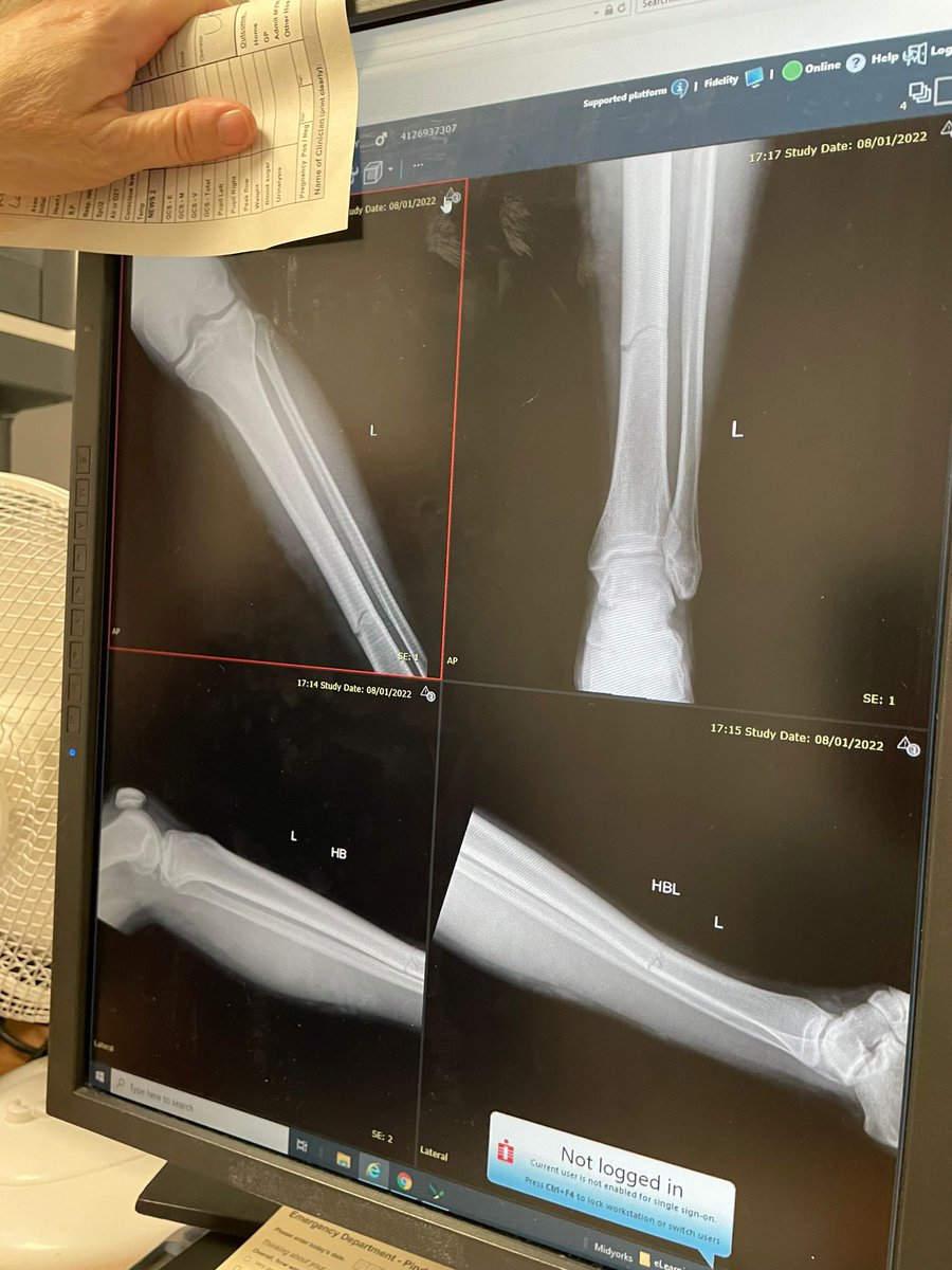 Seconds lost 6-1 to <a href="/MorleyTownAFC/">Morley Town AFC</a> after a very slow start. Wishing Baker a speedy recovery from what was a terrible tackle 🫂💜

Thirds picked up yet another draw against <a href="/CarletonFc/">Fryston FC</a> . goals x3 <a href="/Sam_john13/">Sam Johnson</a> Tenners x1 and a rocket goal from our very own fat Ronaldo <a href="/Tedi5mith/">Aidan Byard</a>