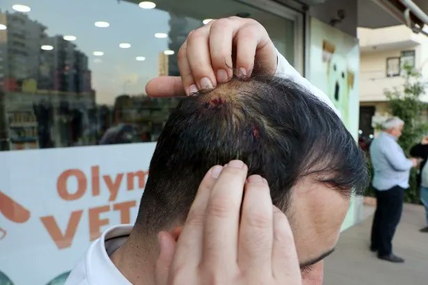 VETERİNER HEKİMLERİN SAĞLIKTA ŞİDDET YASASI KAPSAMINA ALINMASI İÇİN NEYİ BEKLİYORUZ? 

Adana'da görevi esnasında darp edilen meslektaşımıza geçmiş olsun diyor, acil şifalar diliyorum